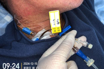 双腔cvc怎么开关双腔 CVC 一腔堵塞，还能继续使用吗？资深护士：这种情况可以_https://www.jmylbn.com_新闻资讯_第2张