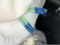 双腔cvc怎么开关双腔 CVC 一腔堵塞，还能继续使用吗？资深护士：这种情况可以_https://www.jmylbn.com_新闻资讯_第8张