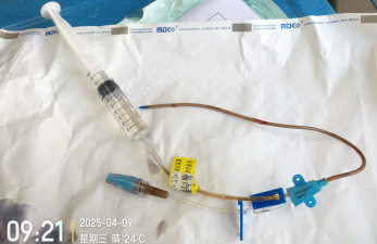 双腔cvc怎么开关双腔 CVC 一腔堵塞，还能继续使用吗？资深护士：这种情况可以_https://www.jmylbn.com_新闻资讯_第4张