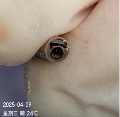 双腔cvc怎么开关双腔 CVC 一腔堵塞，还能继续使用吗？资深护士：这种情况可以_https://www.jmylbn.com_新闻资讯_第5张