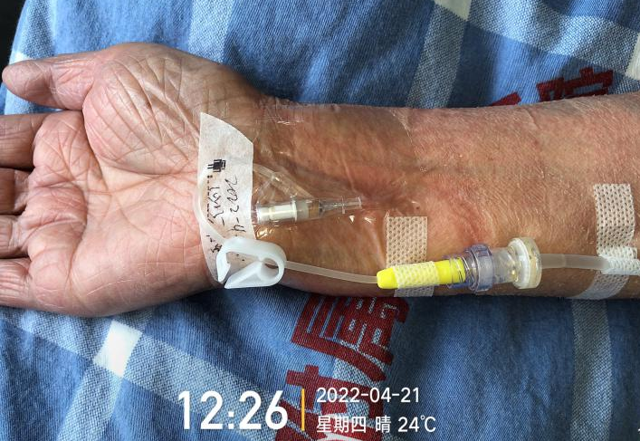 留置针怎么单手推针操作视频：留置针 3 大穿刺法，教你学会正确穿刺！_https://www.jmylbn.com_新闻资讯_第2张