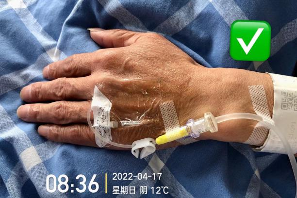 留置针怎么单手推针操作视频：留置针 3 大穿刺法，教你学会正确穿刺！_https://www.jmylbn.com_新闻资讯_第9张