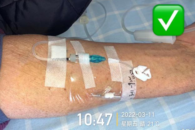 留置针怎么单手推针操作视频：留置针 3 大穿刺法，教你学会正确穿刺！_https://www.jmylbn.com_新闻资讯_第8张