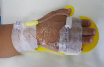 留置针绷带怎么缠儿童留置针不可使用卷绷带固定？这里有答案_https://www.jmylbn.com_新闻资讯_第13张