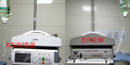 为什么输液泵一直报警怪事！输液时液体竟然倒流，这个错误你我都会犯_https://www.jmylbn.com_新闻资讯_第4张