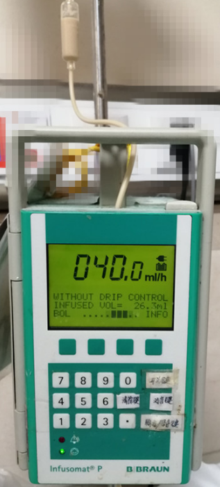 为什么输液泵一直报警怪事！输液时液体竟然倒流，这个错误你我都会犯_https://www.jmylbn.com_新闻资讯_第5张
