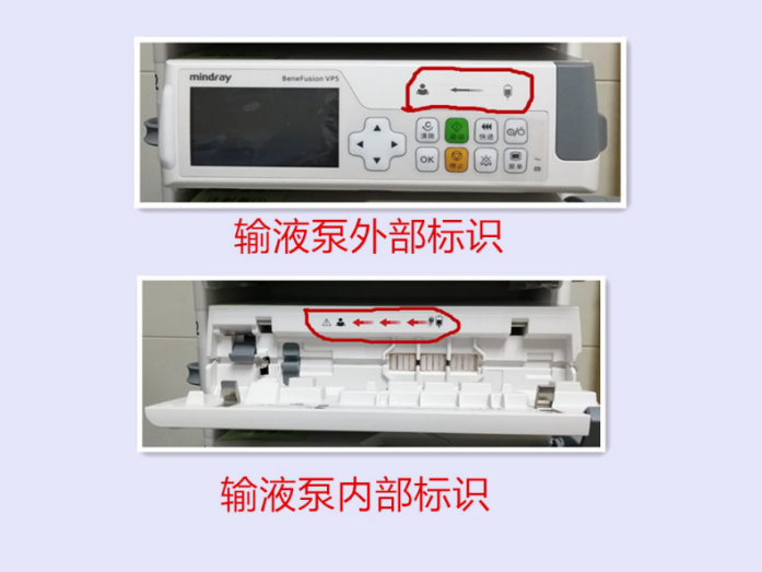 为什么输液泵一直报警怪事！输液时液体竟然倒流，这个错误你我都会犯_https://www.jmylbn.com_新闻资讯_第3张