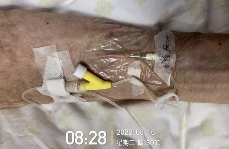 留置针怎么单手推针留置针 5 大穿刺技巧，看过的护士都收藏了！_https://www.jmylbn.com_新闻资讯_第4张