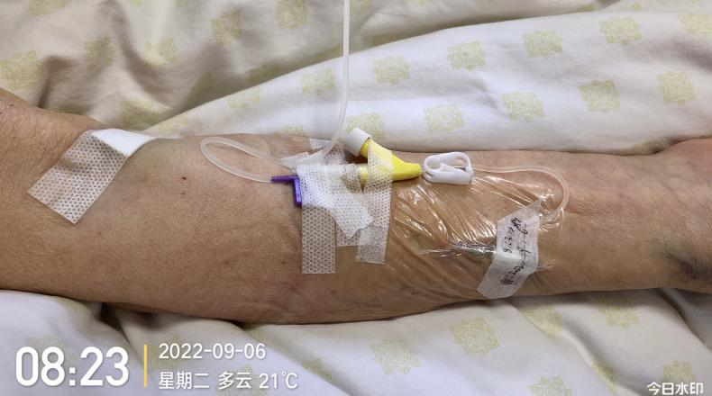 留置针怎么单手推针留置针 5 大穿刺技巧，看过的护士都收藏了！_https://www.jmylbn.com_新闻资讯_第3张