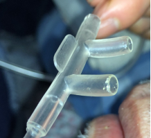 为什么吸氧管子是一边的吸氧管佩戴：塑料搭片，究竟朝上还是朝下？_https://www.jmylbn.com_新闻资讯_第8张