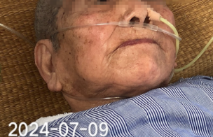 为什么吸氧管子是一边的吸氧管佩戴：塑料搭片，究竟朝上还是朝下？_https://www.jmylbn.com_新闻资讯_第4张