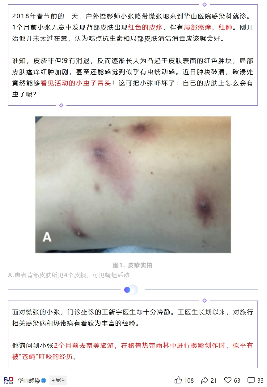 小心！这种恐怖的寄生苍蝇会钻到你的皮肤里面……
