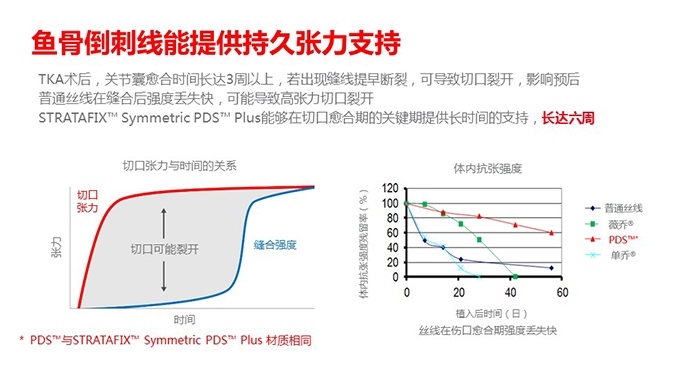 倒刺线怎么缝合鱼骨倒刺线在膝关节置换术中的应用_https://www.jmylbn.com_新闻资讯_第8张