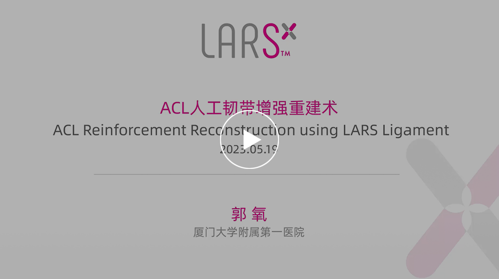 医学上ACL是什么手术精选 ｜ ACL 人工韧带增强重建术暨厦门大学附属第一医院LARS人工韧带增强技术培训班精彩回顾_https://www.jmylbn.com_新闻资讯_第6张