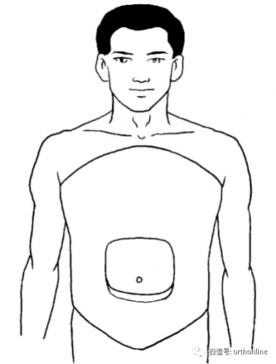 医用石膏夹板怎么软化关于骨折石膏固定技术总结及注意事项_https://www.jmylbn.com_新闻资讯_第13张