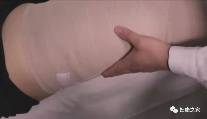 压力绷带为什么那么贵淋巴水肿知多少---CDT之压力治疗_https://www.jmylbn.com_新闻资讯_第23张