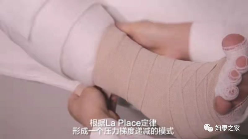 压力绷带为什么那么贵淋巴水肿知多少---CDT之压力治疗_https://www.jmylbn.com_新闻资讯_第19张