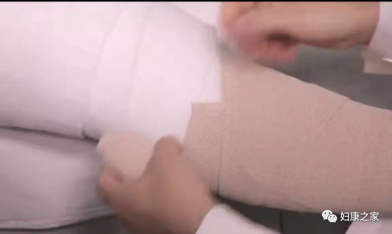 压力绷带为什么那么贵淋巴水肿知多少---CDT之压力治疗_https://www.jmylbn.com_新闻资讯_第22张