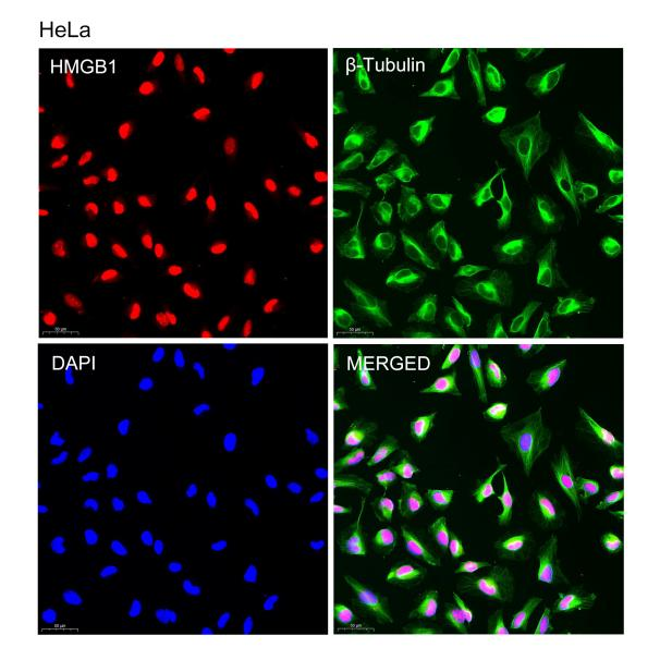 抗体产品星推荐第二十五期|Anti-HMGB1 Polyclonal Antibody