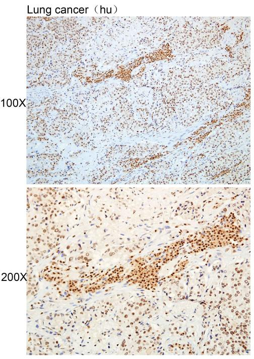 核仁標志物相關標志物