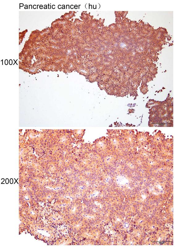 抗体产品星推荐第二十二期|Anti-GNB1 Polyclonal Antibody