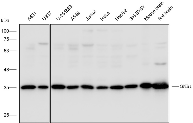 抗体产品星推荐第二十二期|Anti-GNB1 Polyclonal Antibody