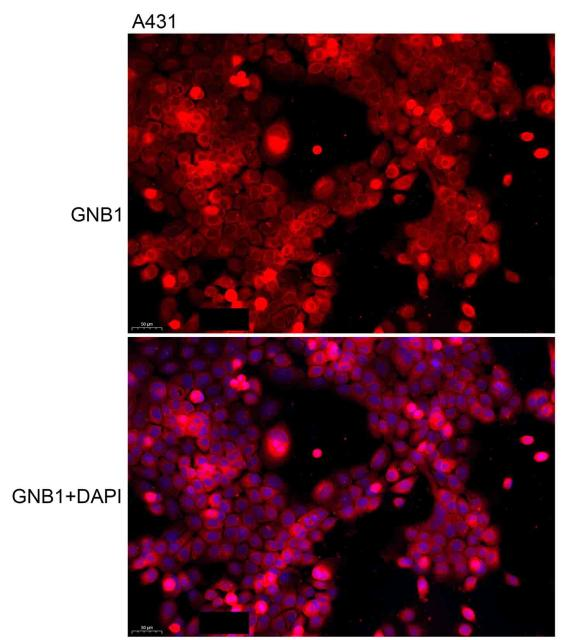 抗体产品星推荐第二十二期|Anti-GNB1 Polyclonal Antibody