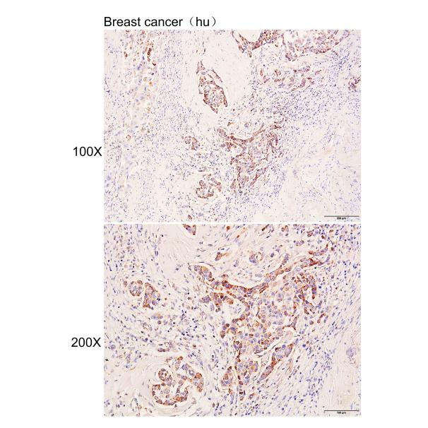 抗体产品星推荐第二十六期|Anti-UQCRC2 Polyclonal Antibody