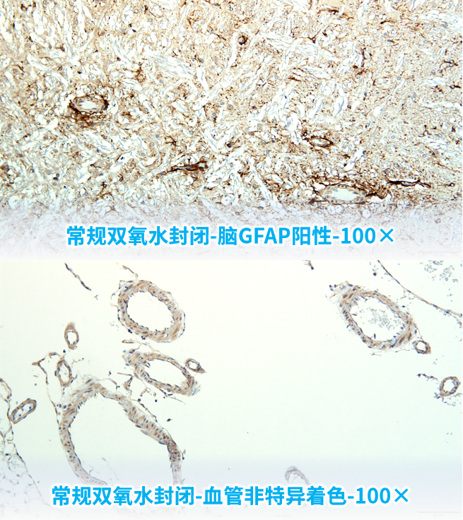 染色液|夏日大作战