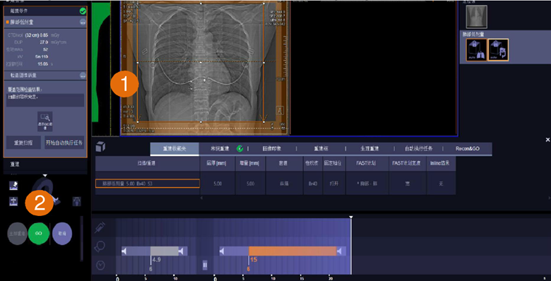 方舱ct怎么取西门子医疗方舱CT操作指南_https://www.jmylbn.com_新闻资讯_第10张