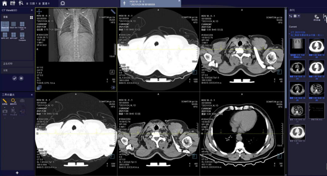方舱ct怎么取西门子医疗方舱CT操作指南_https://www.jmylbn.com_新闻资讯_第15张