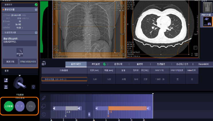 方舱ct怎么取西门子医疗方舱CT操作指南_https://www.jmylbn.com_新闻资讯_第12张
