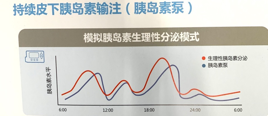 杭州10歲男孩4個月瘦了20斤,還總愛喝水,一查竟是這種病!醫生提醒:別大意,這樣的孩子越來越多…… 健康 第5張