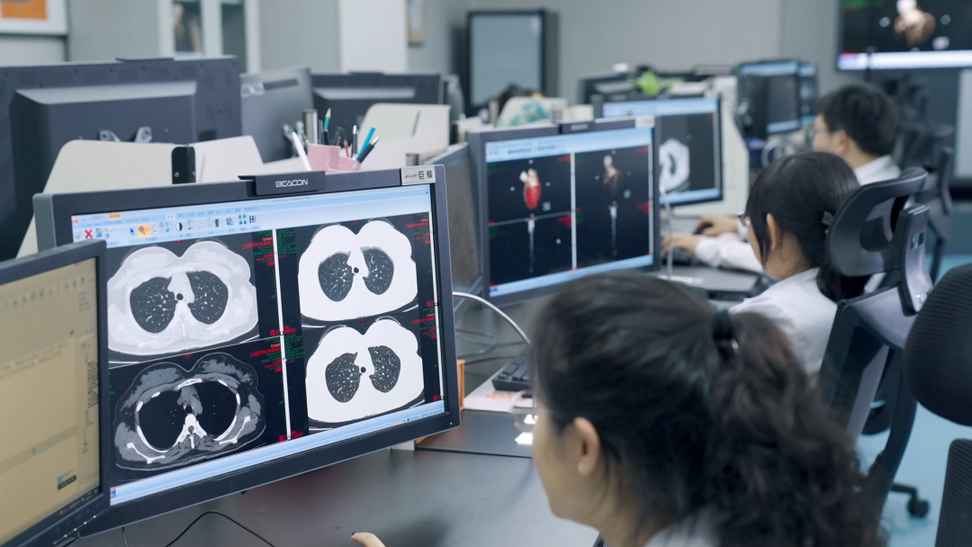 打印胶片是什么省时省力 环保方便 不用排队打印片子了！济南市中心医院推出“云胶片”服务_https://www.jmylbn.com_新闻资讯_第4张