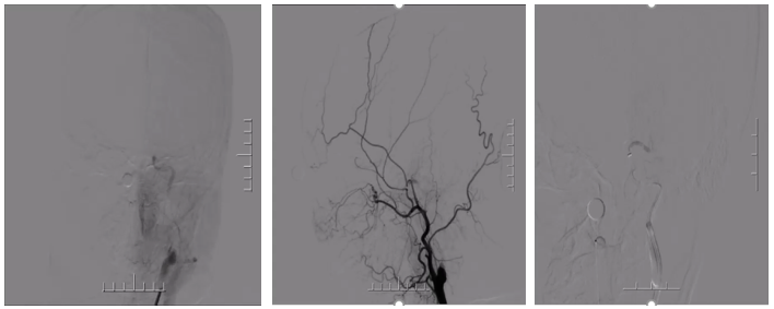 病历夹什么径技·第151期｜串联营病历夹：京广连营_https://www.jmylbn.com_新闻资讯_第27张