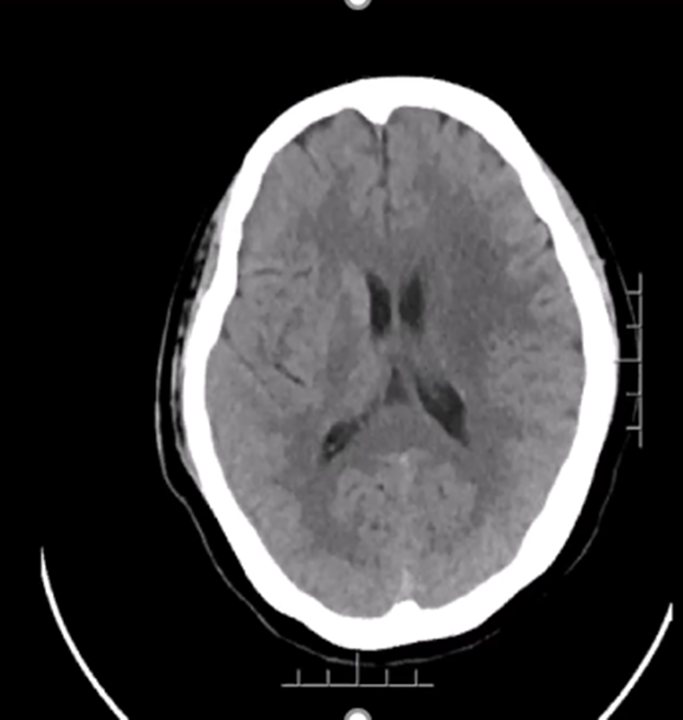 病历夹什么径技·第151期｜串联营病历夹：京广连营_https://www.jmylbn.com_新闻资讯_第25张