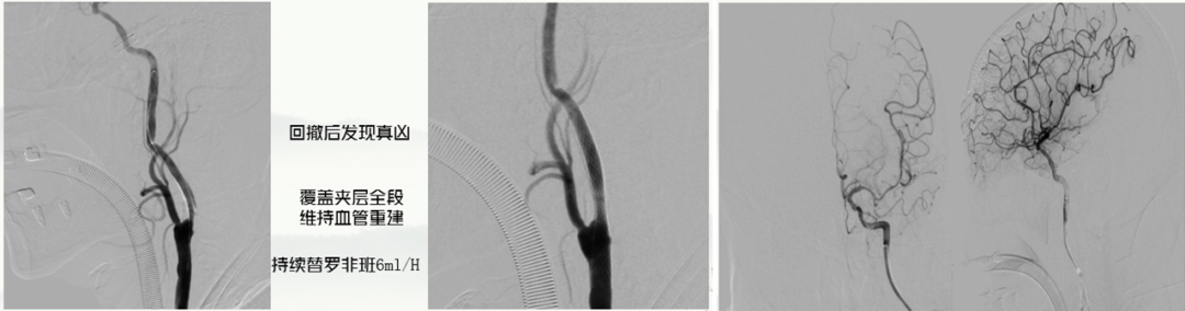 病历夹什么径技·第151期｜串联营病历夹：京广连营_https://www.jmylbn.com_新闻资讯_第13张