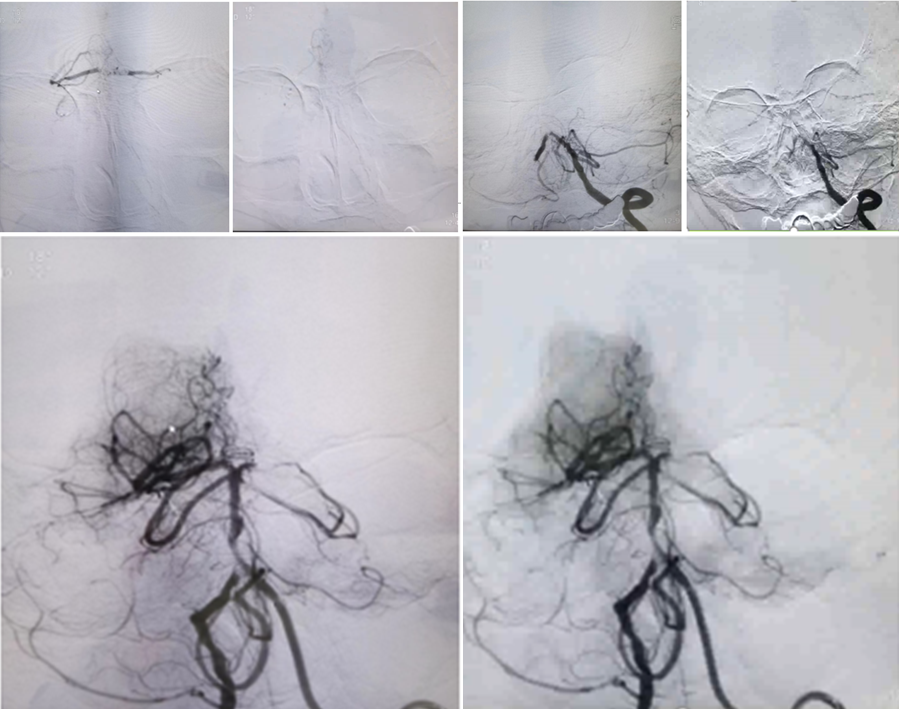 病历夹什么径技·第151期｜串联营病历夹：京广连营_https://www.jmylbn.com_新闻资讯_第75张