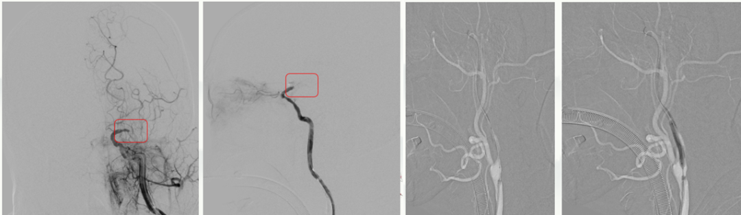 病历夹什么径技·第151期｜串联营病历夹：京广连营_https://www.jmylbn.com_新闻资讯_第10张