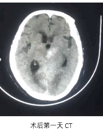 病历夹什么径技·第151期｜串联营病历夹：京广连营_https://www.jmylbn.com_新闻资讯_第79张