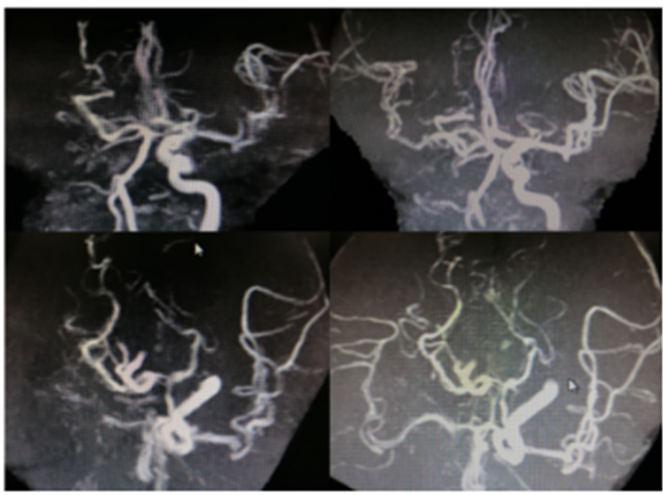 病历夹什么径技·第151期｜串联营病历夹：京广连营_https://www.jmylbn.com_新闻资讯_第57张