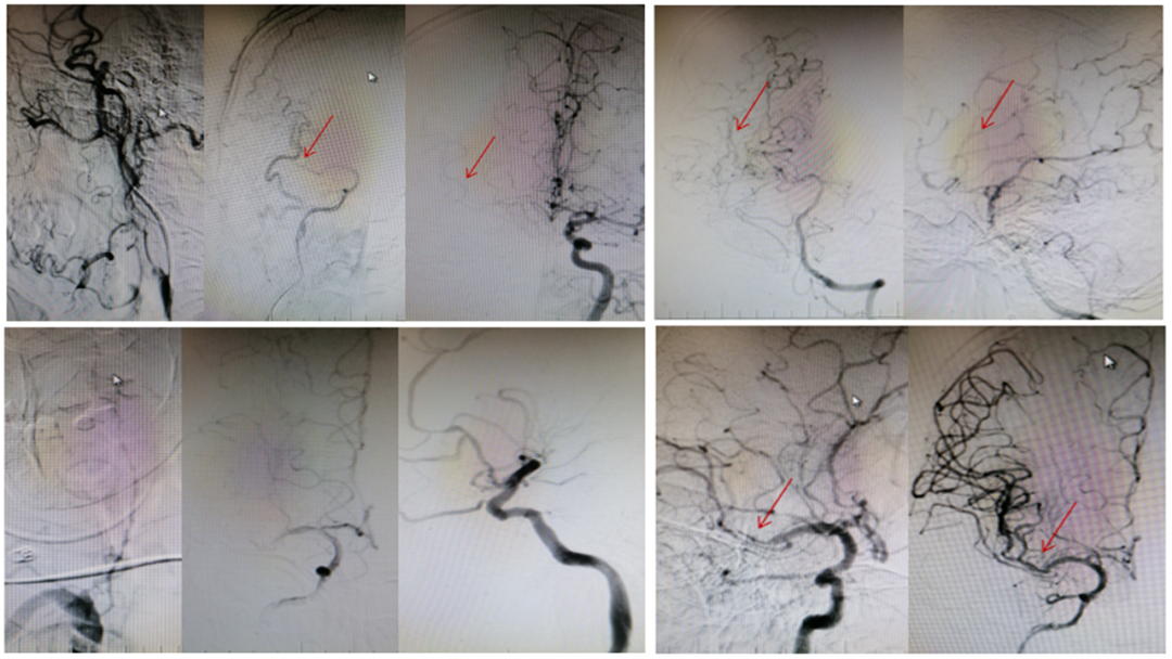 病历夹什么径技·第151期｜串联营病历夹：京广连营_https://www.jmylbn.com_新闻资讯_第56张