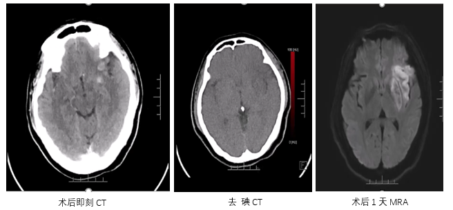 病历夹什么径技·第151期｜串联营病历夹：京广连营_https://www.jmylbn.com_新闻资讯_第30张