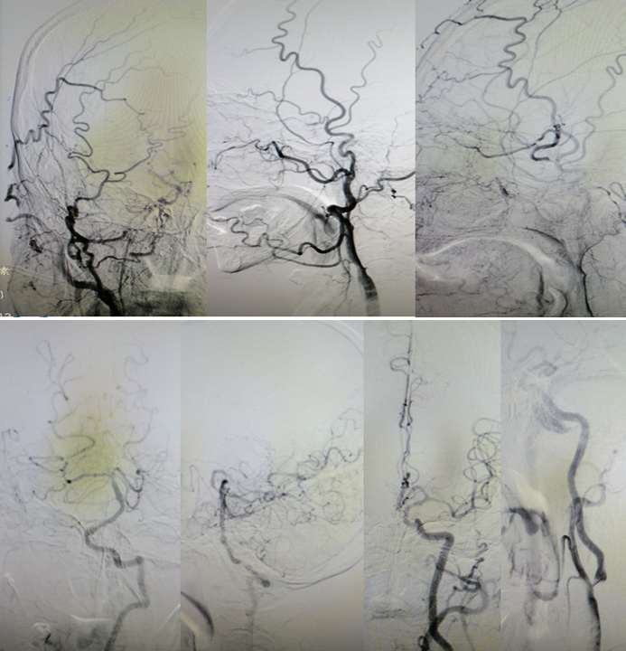 病历夹什么径技·第151期｜串联营病历夹：京广连营_https://www.jmylbn.com_新闻资讯_第61张