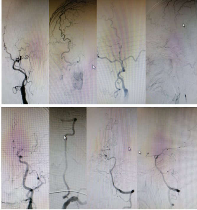 病历夹什么径技·第151期｜串联营病历夹：京广连营_https://www.jmylbn.com_新闻资讯_第55张