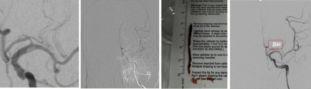 病历夹什么径技·第151期｜串联营病历夹：京广连营_https://www.jmylbn.com_新闻资讯_第11张