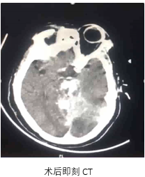病历夹什么径技·第151期｜串联营病历夹：京广连营_https://www.jmylbn.com_新闻资讯_第78张