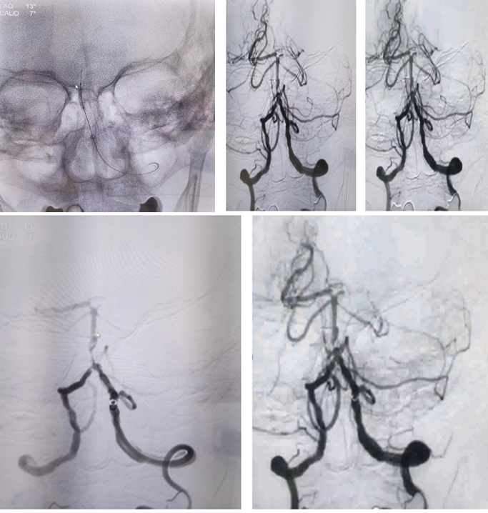 病历夹什么径技·第151期｜串联营病历夹：京广连营_https://www.jmylbn.com_新闻资讯_第76张