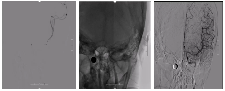 病历夹什么径技·第151期｜串联营病历夹：京广连营_https://www.jmylbn.com_新闻资讯_第28张