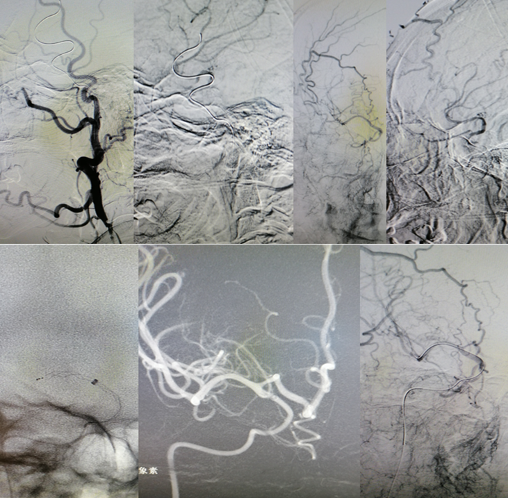 病历夹什么径技·第151期｜串联营病历夹：京广连营_https://www.jmylbn.com_新闻资讯_第63张